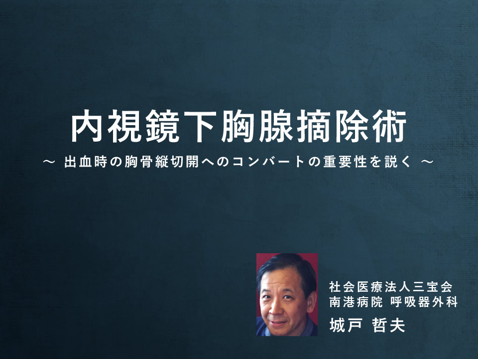 内視鏡下胸腺摘除術 一出血時の胸骨縦切開へのコンバートの重要性を説くー